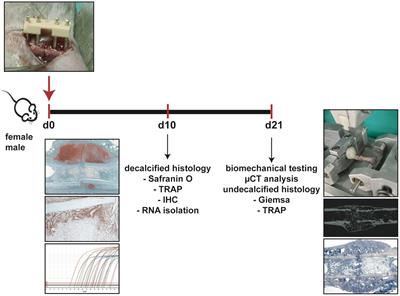 Differences in Fracture Healing Between Female and Male C57BL/6J Mice